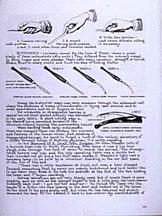 Antique Medical Instruments, 6th Edition by Keith Wilbur